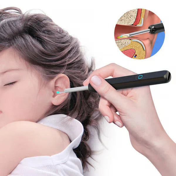 Easy Ear Cleaner Set with Camera